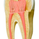 Illustration for article titled Wisdom Teeth do you have it?